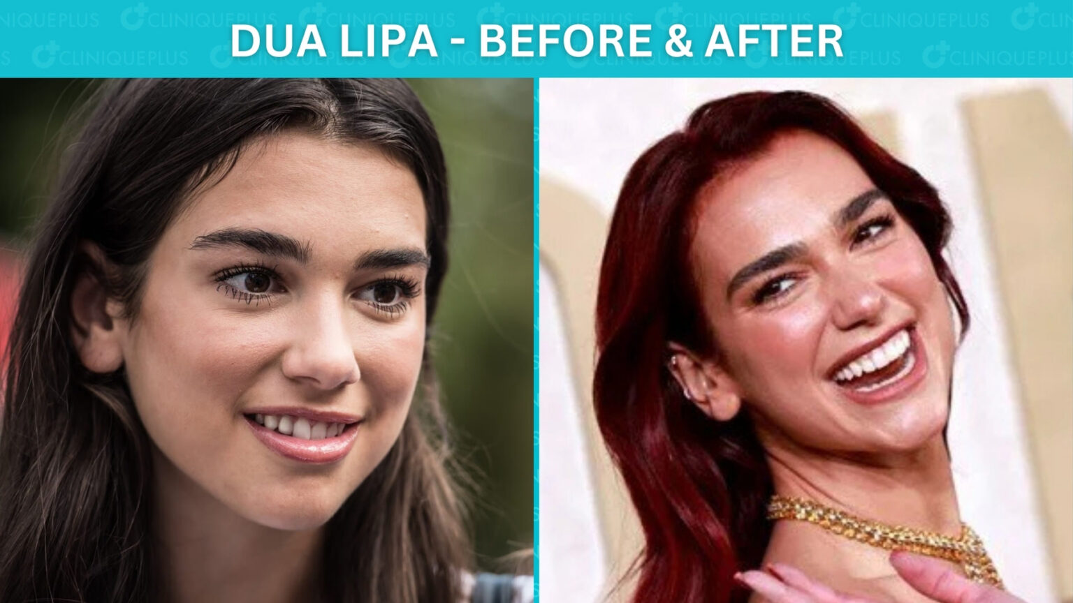 Inspiring Dua Lipa Before And After Pictures