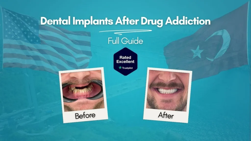 Dental implants before and after drug addiction recovery — full mouth reconstruction at CLINIQUEPLUS Istanbul, US patient