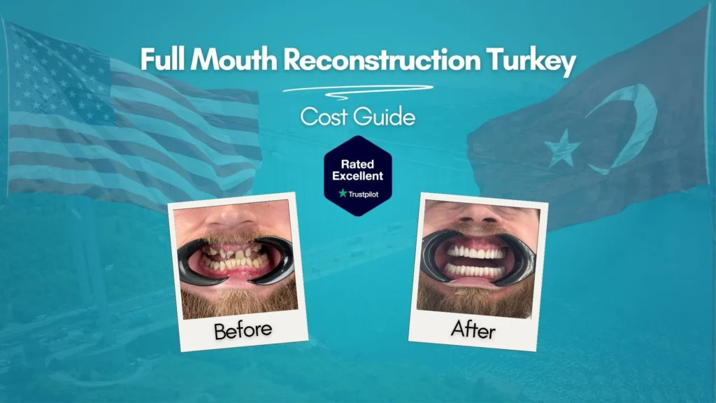 Full mouth reconstruction before and after Turkey — severe tooth damage restored with dental implants at CLINIQUEPLUS Istanbul, US patient, rated Excellent on Trustpilot