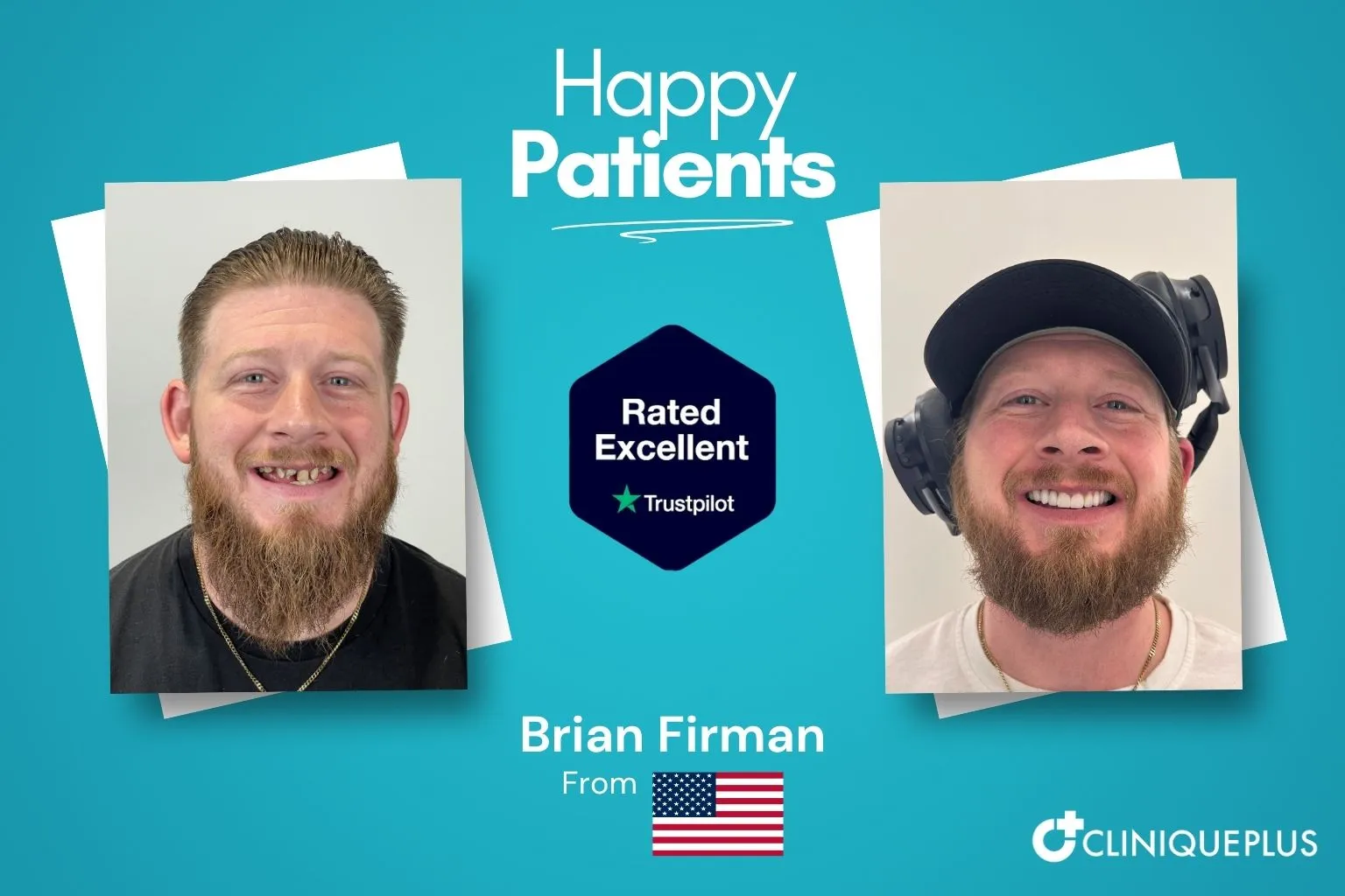 Brian Firman from the USA — before and after affordable dental implants at CLINIQUEPLUS Istanbul Turkey, missing teeth fully restored, rated Excellent on Trustpilot