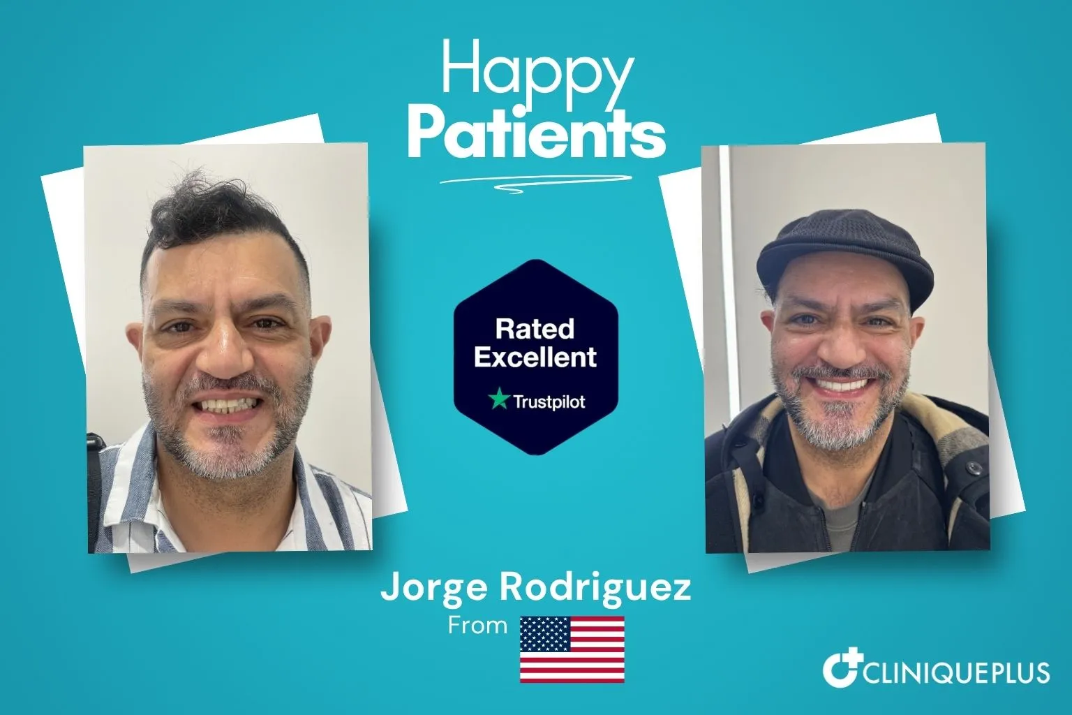 Jorge Rodriguez from the USA — before and after affordable dental treatment at CLINIQUEPLUS Istanbul Turkey, smile transformation, rated Excellent on Trustpilot