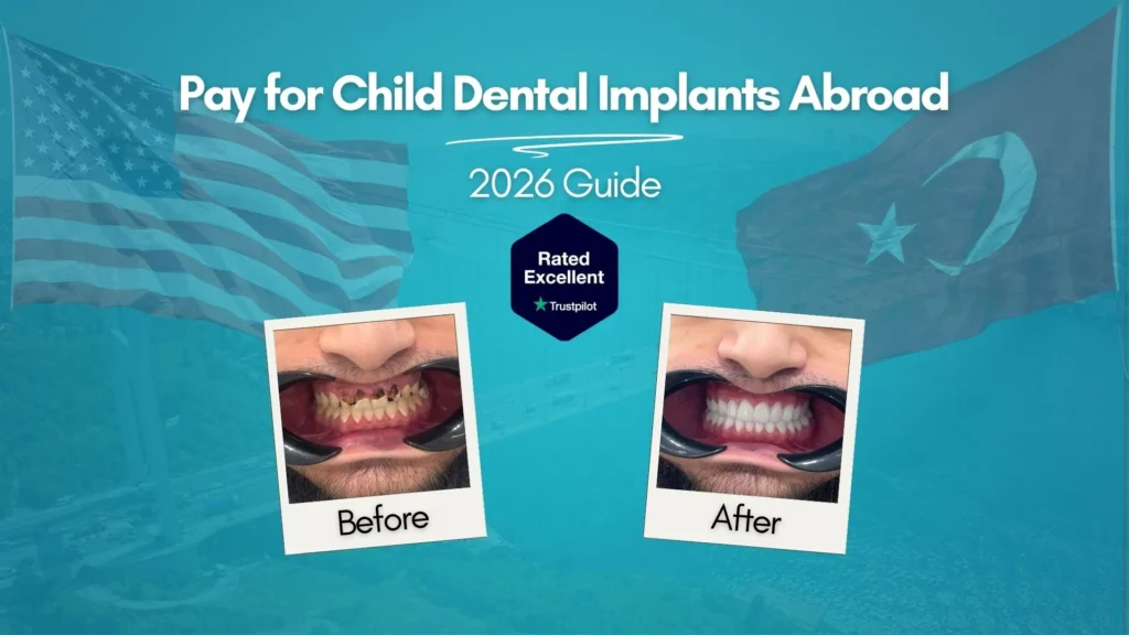 Pay for child dental implants abroad 2026 — before and after full arch reconstruction at CLINIQUEPLUS Istanbul Turkey, US patient, rated Excellent on Trustpilot